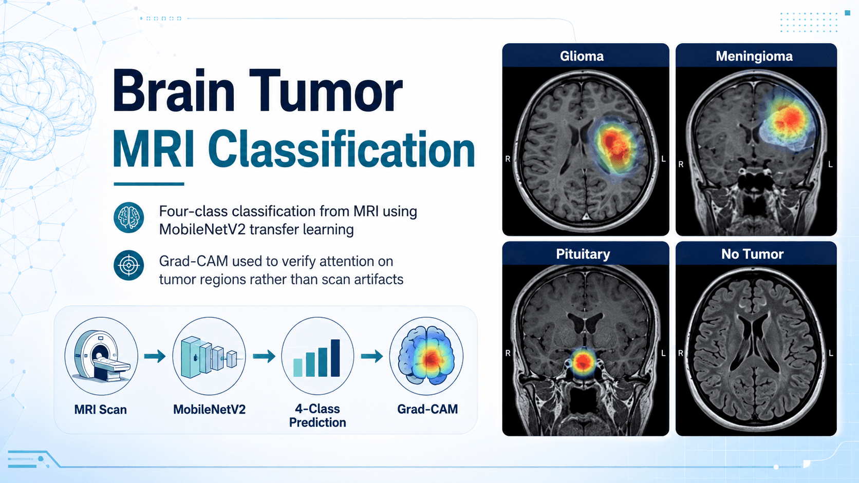 Cover image for Brain Tumor MRI Classification
