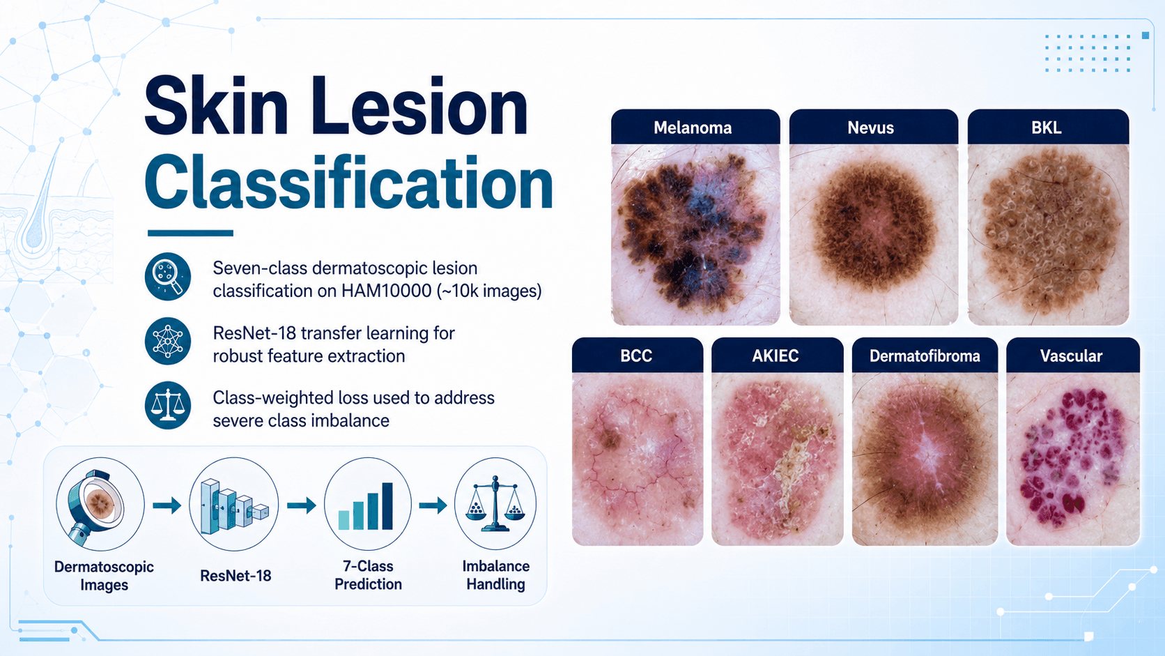 Cover image for Skin Lesion Classification